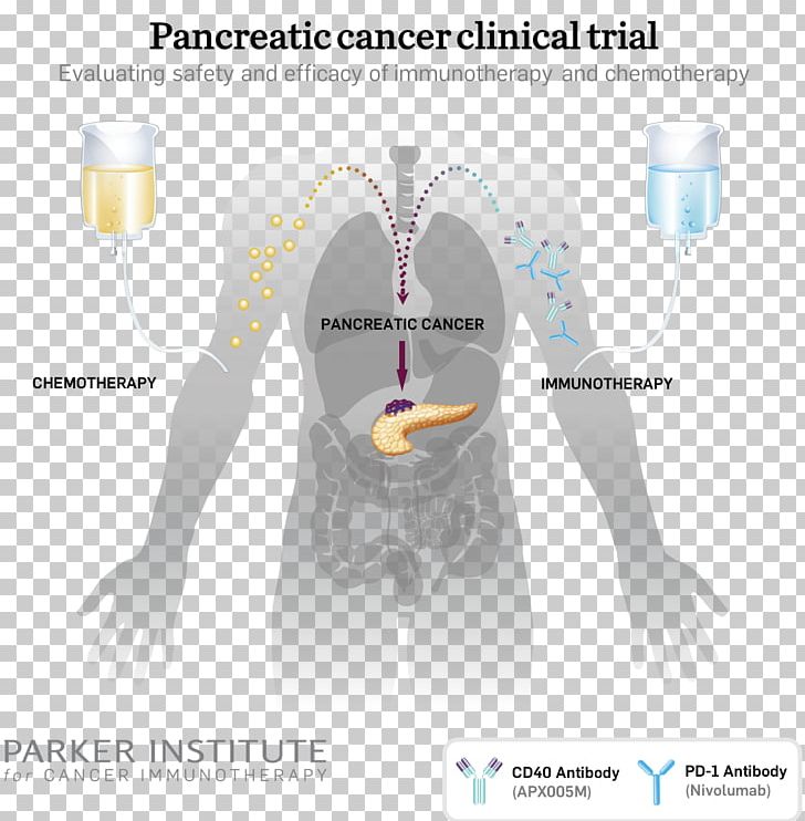 Pancreatic Cancer Cancer Immunotherapy Cancer Research Institute PNG, Clipart, Cancer Immunotherapy, Cancer Research, Cancer Research Institute, Human Body, Joint Free PNG Download