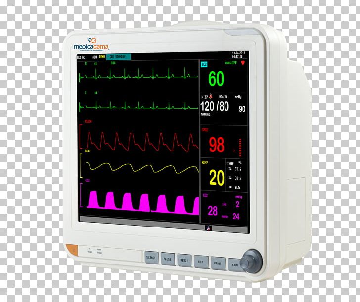 Computer Monitors Medical Equipment Patient Medicine Display Device PNG, Clipart, Advanced Science, Agama, Computer Hardware, Computer Monitors, Display Device Free PNG Download