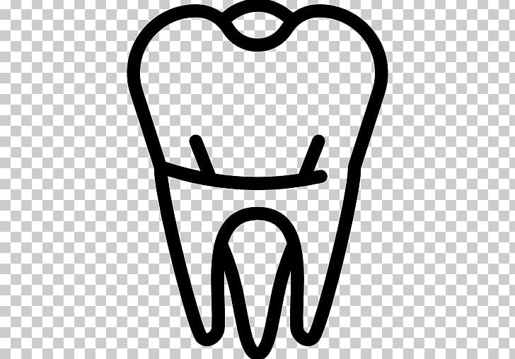 Dentistry Tooth Dentures Molar PNG, Clipart, Black And White, Cosmetic Dentistry, Dental Implant, Dentist, Dentistry Free PNG Download