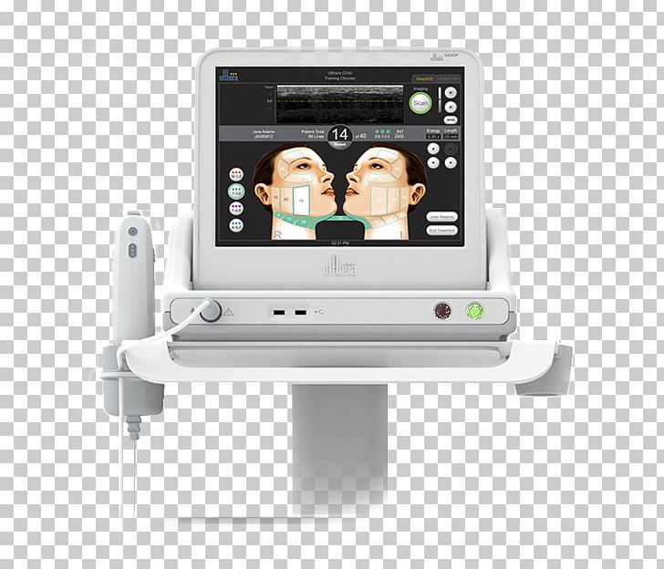 High-intensity Focused Ultrasound Surgery Skin Care Rhytidectomy PNG, Clipart, Botulinum Toxin, Display Device, Electronic Device, Electronics, Food And Drug Administration Free PNG Download