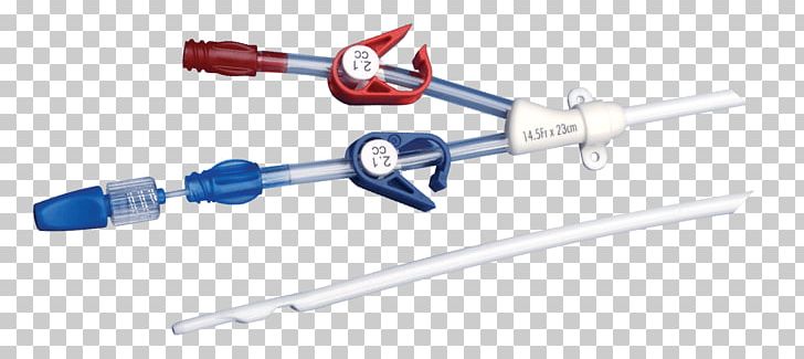 Dialysis Catheter Hemodialysis Peritoneal Dialysis PNG, Clipart, Angle, Auto Part, Blood, Catheter, Catheter Ablation Free PNG Download