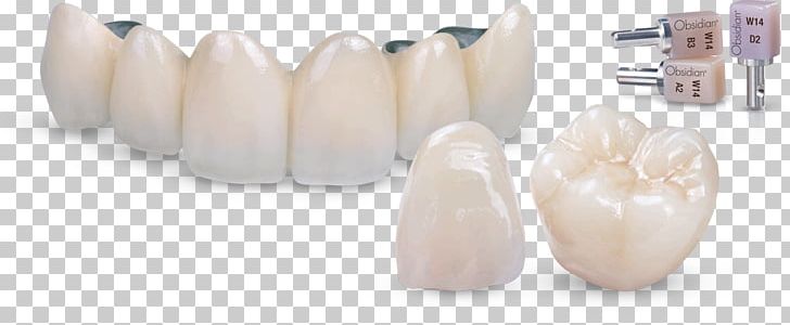 Tooth Ceramic Crown Dental Porcelain PNG, Clipart, Ceramic, Ceramic Art, Ceramist, Crown, Dental Free PNG Download