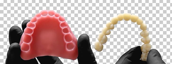 3D Printing Dentures EnvisionTEC Dentistry PNG, Clipart, 3d Printing, Cadcam Dentistry, Communication, Company, Dental Prosthesis Free PNG Download