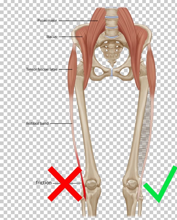 Knee Iliotibial Band Syndrome