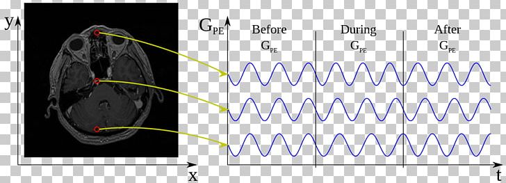 Physics Of Magnetic Resonance Imaging Wikimedia Commons Phase Angle PNG, Clipart, Angle, Area, Circle, Diagram, Encoding Free PNG Download