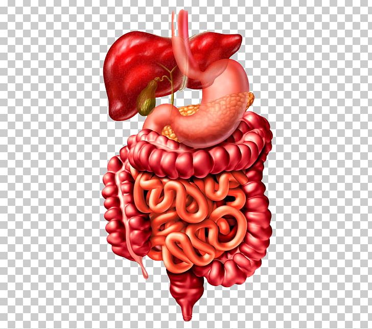 Crohn's Disease Bowel Obstruction Symptom Inflammatory Bowel Disease Large Intestine PNG, Clipart,  Free PNG Download
