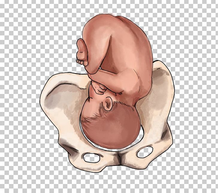 Childbirth Fetal Position Infant Breech Birth PNG, Clipart,  Free PNG Download