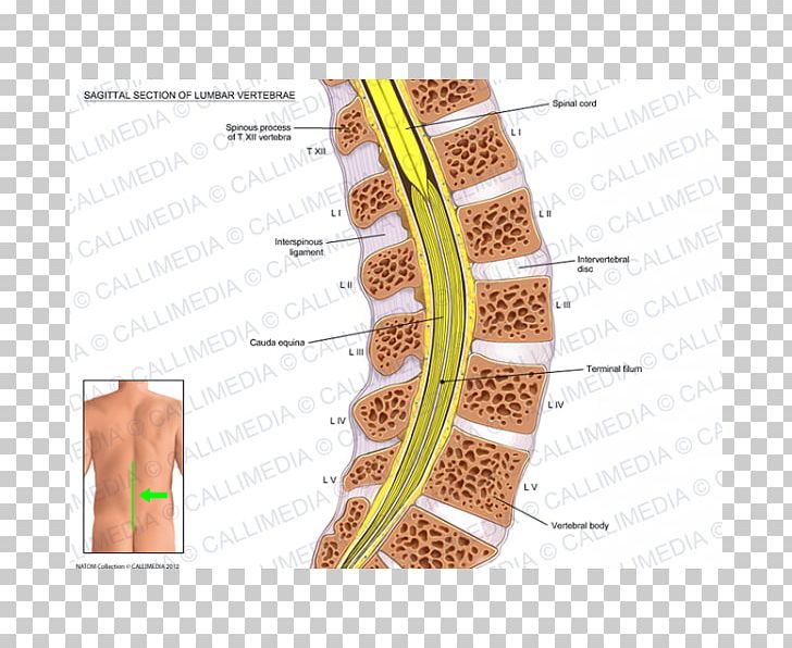 Sagittal Plane Vertebral Column Lumbar Vertebrae Spinal Anaesthesia PNG, Clipart, Abdomen, Anatomy, Anesthesia, Angle, Coronal Plane Free PNG Download