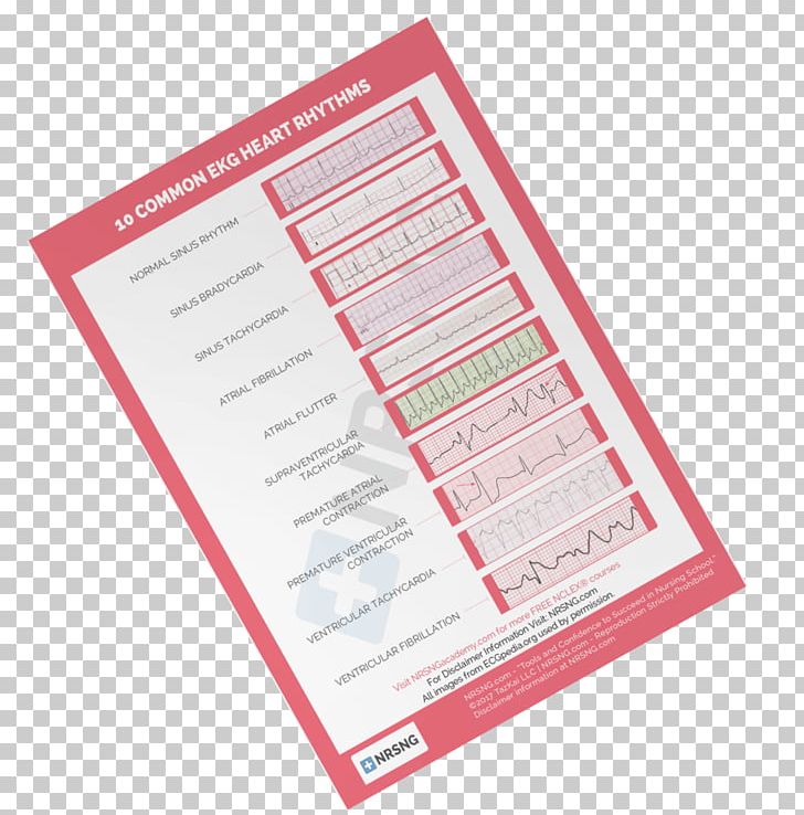 Heart Arrhythmia Mobile Phones Electrocardiography Atrial Flutter Sinus Tachycardia PNG, Clipart, Atrial Fibrillation, Atrial Flutter, Atrium, Electrocardiography, Heart Free PNG Download
