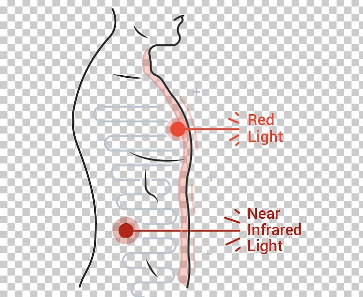 Light Therapy Infrared PNG, Clipart, Abdomen, Angle, Area, Arm, Diagram Free PNG Download