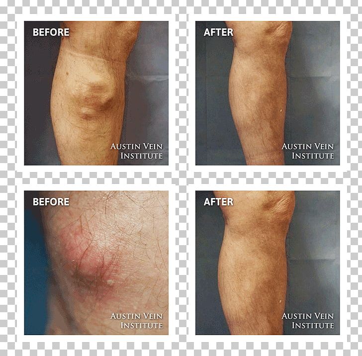 Knee PNG, Clipart, Abdomen, Arm, Chest, Chin, Disease Free PNG Download