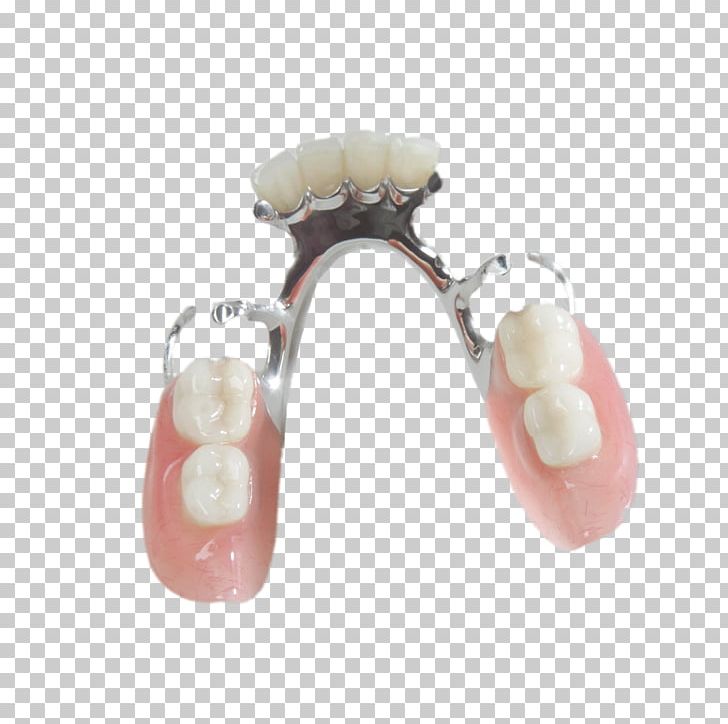 Tooth Dentures Prosthesis Removable Partial Denture Dentistry PNG, Clipart, Body Jewelry, Cosmetic Dentistry, Crown, Dental Implant, Dental Laboratory Free PNG Download