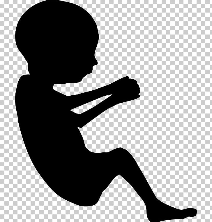 Fetus Pregnancy Mother Placenta PNG, Clipart, Arm, Black And White, Child, Drawing, Fetus Free PNG Download