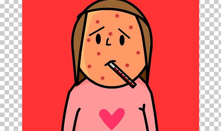 Chickenpox Itch PNG, Clipart, Blog, Cartoon, Child, Disease, Eye Free PNG Download