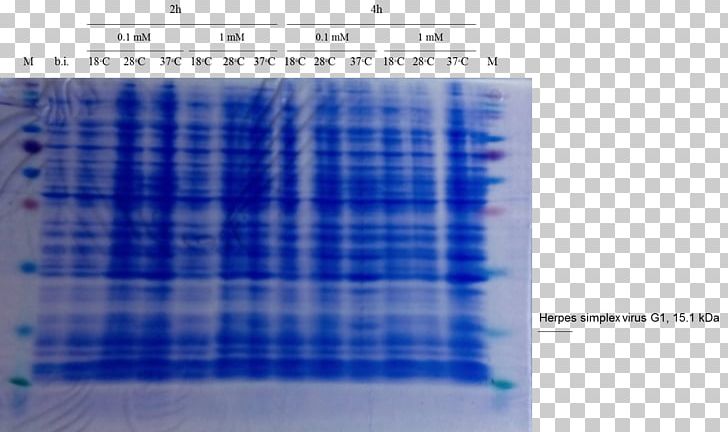 Western Blot Cell SDS-PAGE Staining Polyacrylamide Gel Electrophoresis PNG, Clipart, Angle, Blot, Blue, Brand, Cell Free PNG Download