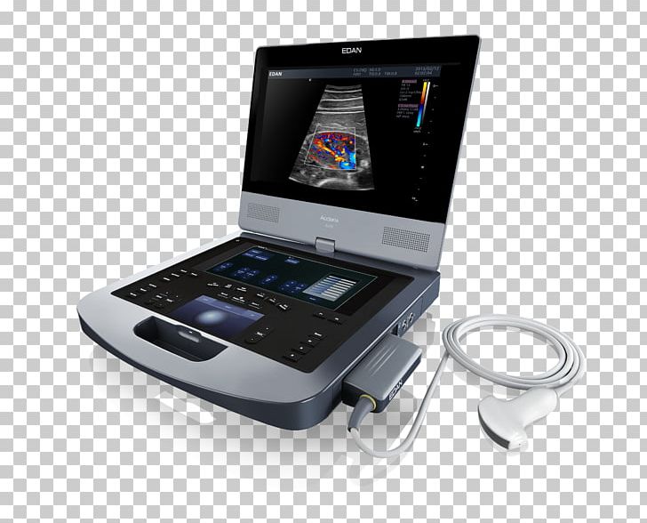 Ultrasonography Ultrasound Doppler Echocardiography Medical Diagnosis Medical Imaging PNG, Clipart, Computer Monitor Accessory, Electronic Device, Electronics, Gadget, Medical Diagnosis Free PNG Download