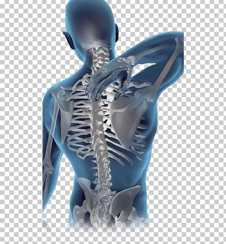 Musculoskeletal Disorder Mills Chiropractic Back Pain Vertebral Column PNG, Clipart, Back Pain, Chiropractic, Chiropractor, Electric Blue, Health Care Free PNG Download