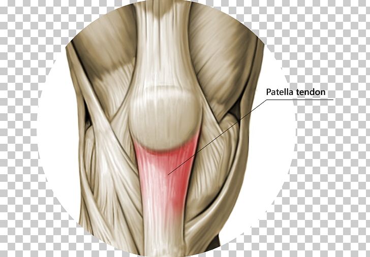 Knee Patellar Tendinitis Tendon Patellar Ligament PNG, Clipart, Ache, Anatomy, Femur, Human Body, Jaw Free PNG Download