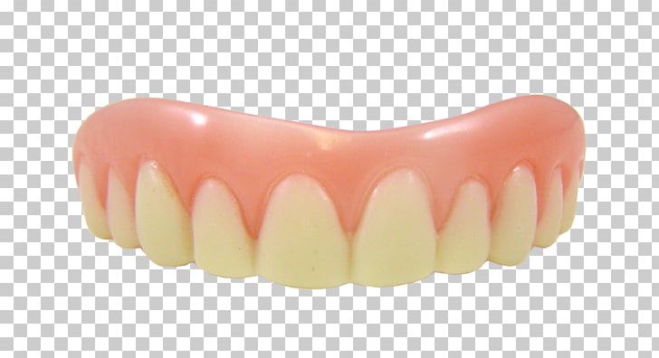 Veneer Dentures Dentistry Tooth Cosmetics PNG, Clipart, Bad Breath, Cosmetic Dentistry, Cosmetics, Dental Restoration, Dentistry Free PNG Download