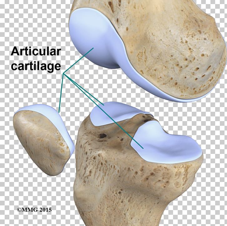 Articular Cartilage Damage Joint Articular Cartilage Repair Cartílago Articular PNG, Clipart, Articular Cartilage Damage, Articular Cartilage Repair, Bone, Cartilage, Femur Free PNG Download