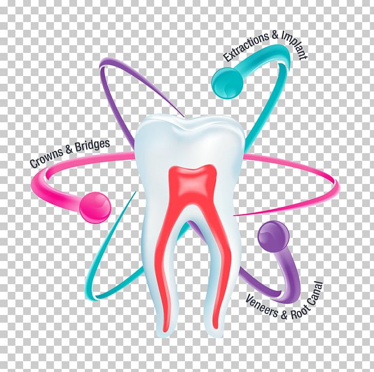 Tooth Family Dental Center Dentistry Crown PNG, Clipart, Body Jewelry, Crown, Dental Extraction, Dental Implant, Dental Restoration Free PNG Download