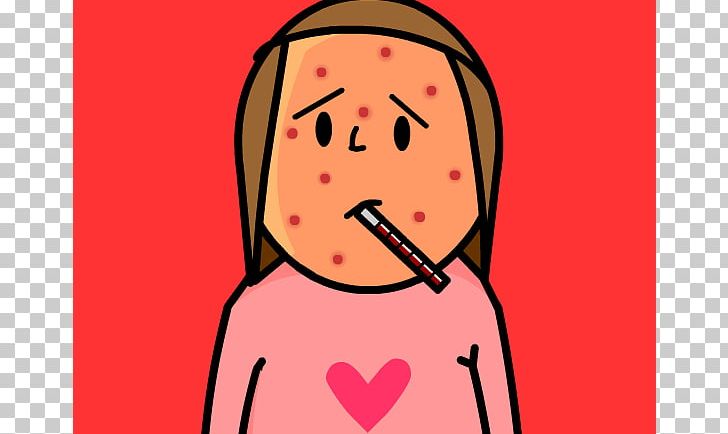 Chickenpox Itchy PNG, Clipart, Art, Cartoon, Cheek, Child, Contagious Disease Free PNG Download