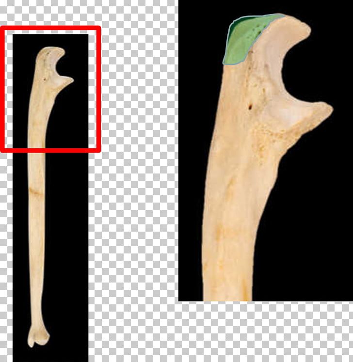 olecranon process ulna