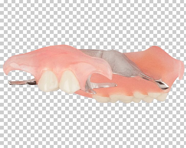 Dentures Removable Partial Denture Tooth Dentistry Home Improvement PNG, Clipart, Angle, Aspen Dental, Bathroom, Bedroom Floor, Dentistry Free PNG Download