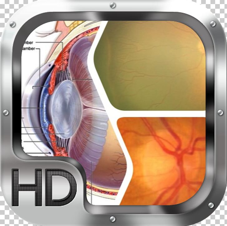 Human Eye Cataract Visual System Sense PNG, Clipart, Abdul, Agy, Anmar, Calculator, Cataract Free PNG Download