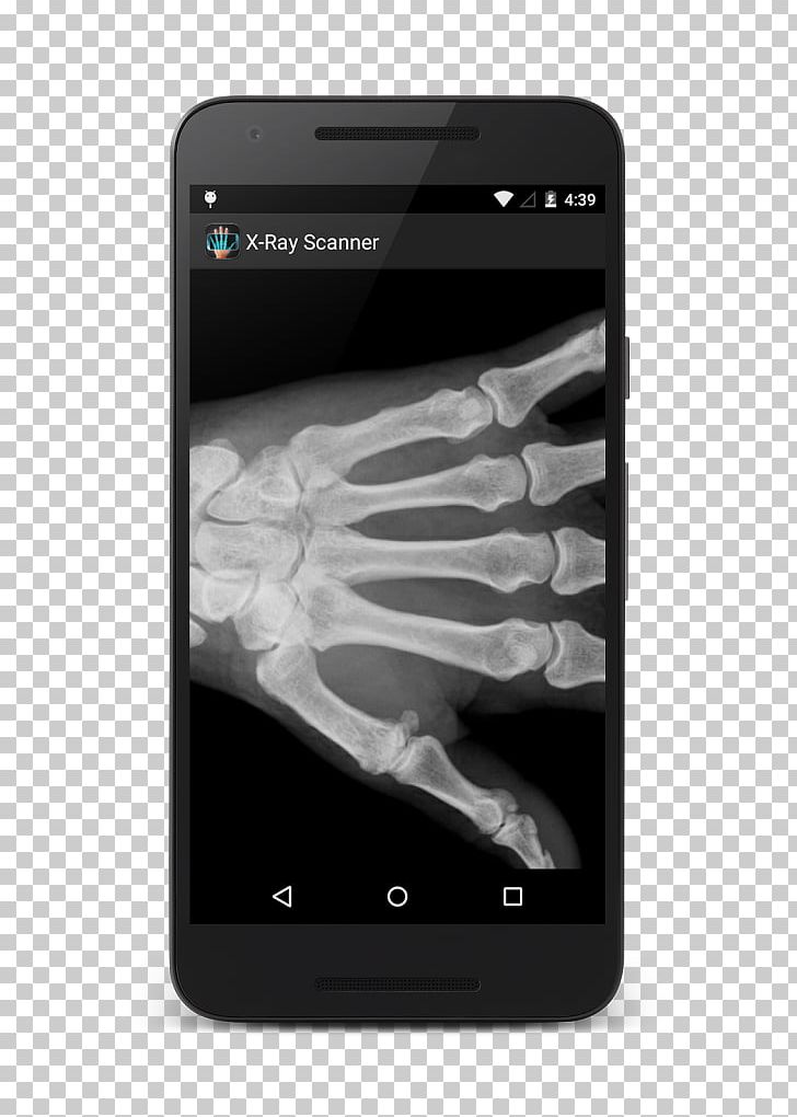 Smartphone Nailbiters X-ray Scanner Prank IPhone X Android PNG, Clipart, Android, Communication Device, Computer Software, Electronic Device, Electronics Free PNG Download