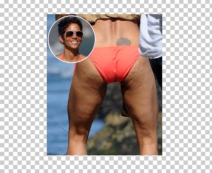 young celebrities with stretch marks