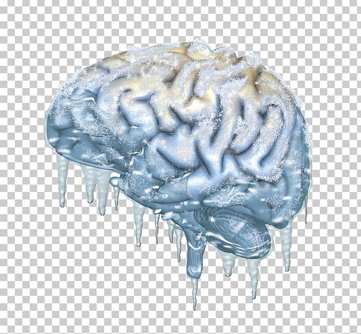 Cold-stimulus Headache Brain Stock Photography Cryonics PNG, Clipart, Brain, Coldstimulus Headache, Cryonics, Forehead, Freezing Free PNG Download