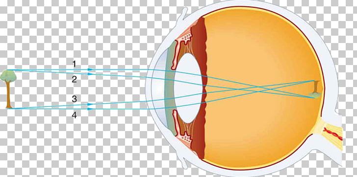 Retina Human Eye Light PNG, Clipart, Anatomy, Angle, Blind Spot, Circle, Cone Cell Free PNG Download