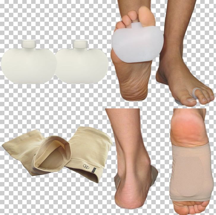 Toe Podalgia Ball Foot Shoe Insert PNG, Clipart,  Free PNG Download