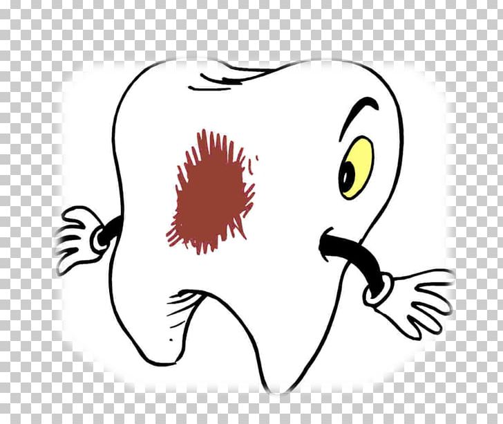 Tooth Decay Drawing Coloring Book PNG, Clipart, Animation, Art, Artwork, Beak, Caries Free PNG Download