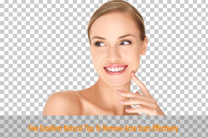 Face Cosmetics Beauty Injectable Filler Skin PNG, Clipart, Beauty, Cheek, Chin, Chirurgia Estetica, Cosmetics Free PNG Download