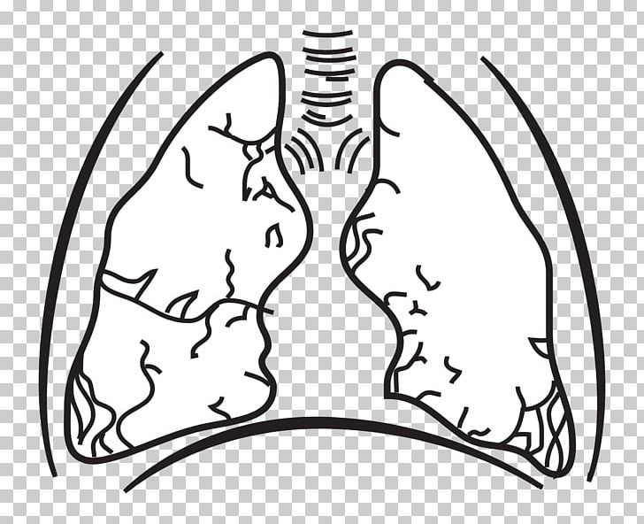 Great Hungarian Plain Lung Breathing PNG, Clipart, Anatomy, Arm, Black, Breathing, Cartoon Free PNG Download