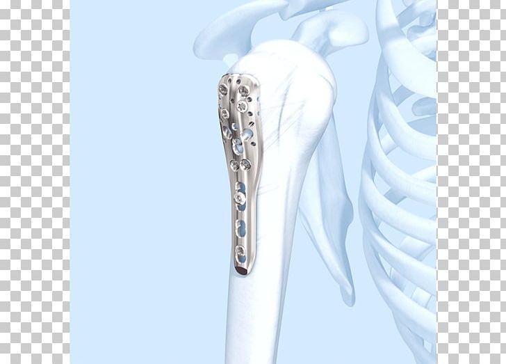 Shoulder Humerus Fracture Bone Diaphysis PNG, Clipart, Bone, Bone Fracture, Brachial Artery, Brachialis Muscle, Hand Free PNG Download