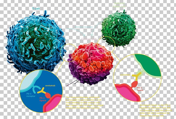 Avelumab PD-L1 Ovarian Cancer Chemotherapy PNG, Clipart, Antibody, Avelumab, Breakthrough, Cancer, Cell Free PNG Download