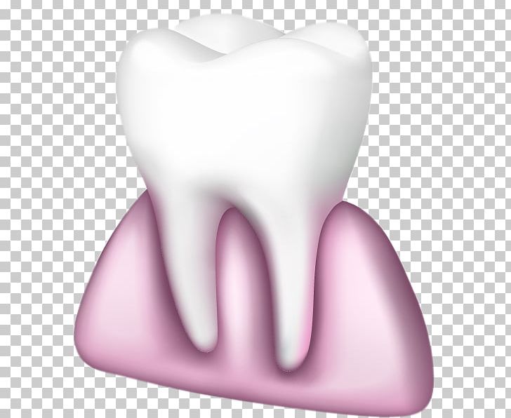 Tooth Pathology Chewing Gum Gums PNG, Clipart, 3d Computer Graphics, Baby Teeth, Bubble Gum, Cartoon, Cartoon Tooth Free PNG Download