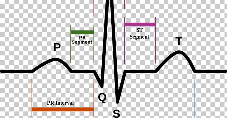 Electrocardiography Heart Rate Pulse Diagram PNG, Clipart, Angle, Area, Brand, Cardiology, Diagram Free PNG Download