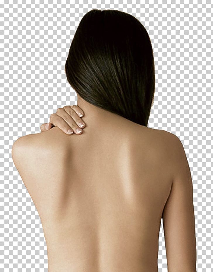 Acne Pimple Human Back Scar Collagen Induction Therapy PNG, Clipart, Arm, Back, Back Beauty, Beauty Back, Black Hair Free PNG Download