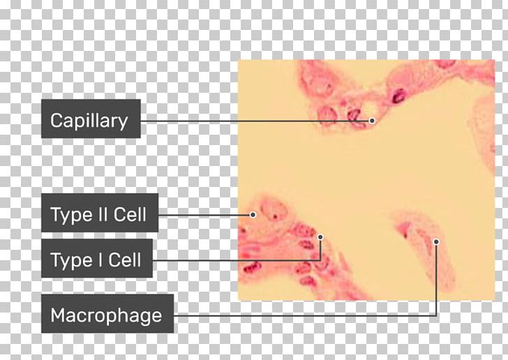 Alveolar Macrophage Pulmonary Alveolus Cell Lung PNG, Clipart, Alveolar Macrophage, Anatomy, Angle, Brand, Capillary Free PNG Download