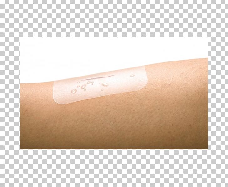 Dressing Film Tegaderm Skin Ulcer Wound PNG, Clipart, Adhesive Tape, Antiseptic, Arm, Burn, Catheter Free PNG Download