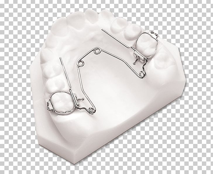 Orthodontics Retainer Overjet Overbite Jaw PNG, Clipart, 3 D, Appliances, Body Jewelry, Cheek, Helix Free PNG Download