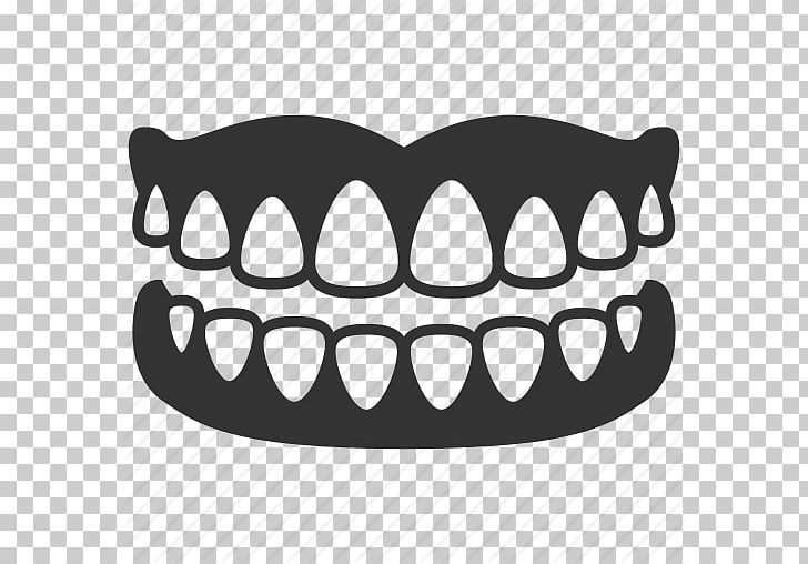 Computer Icons Dentistry Dentures Tooth Dental Implant PNG, Clipart, Allon4, Black And White, Computer Icons, Dental Implant, Dental Instruments Free PNG Download