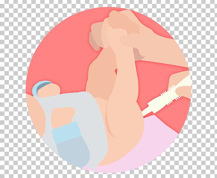 Infant Gas Pregnancy Ache Flatulence PNG, Clipart, Ache, Aspirator, Baby Colic, Cheek, Circle Free PNG Download