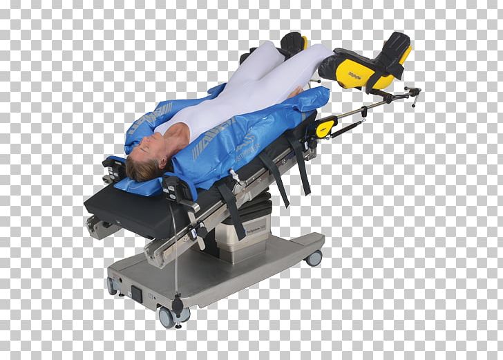 Trendelenburg Position Surgery Operating Table Gynaecology Allen Medical Systems PNG, Clipart, Advamed, Allen Medical Systems Inc, Bariatrics, Gynaecology, Hardware Free PNG Download