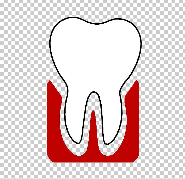 Mikros Tooth Pediatric Dentistry Periodontology PNG, Clipart, Area, Chernivtsi, Clinic, Dental Implant, Dentistry Free PNG Download