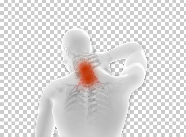 Back Pain Pain Management Sciatica Spinal Cord Stimulator Epidural Administration PNG, Clipart, Back Pain, Drinkware, Ear, Epidural, Epidural Administration Free PNG Download